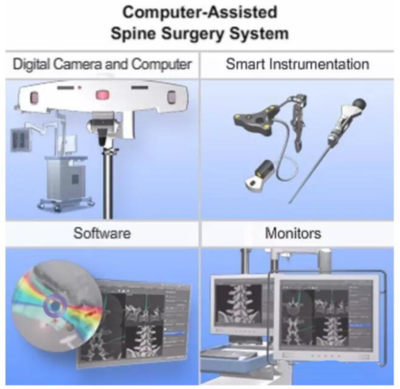 计算机辅助脊柱外科手术(Computer-assisted spine surgery)